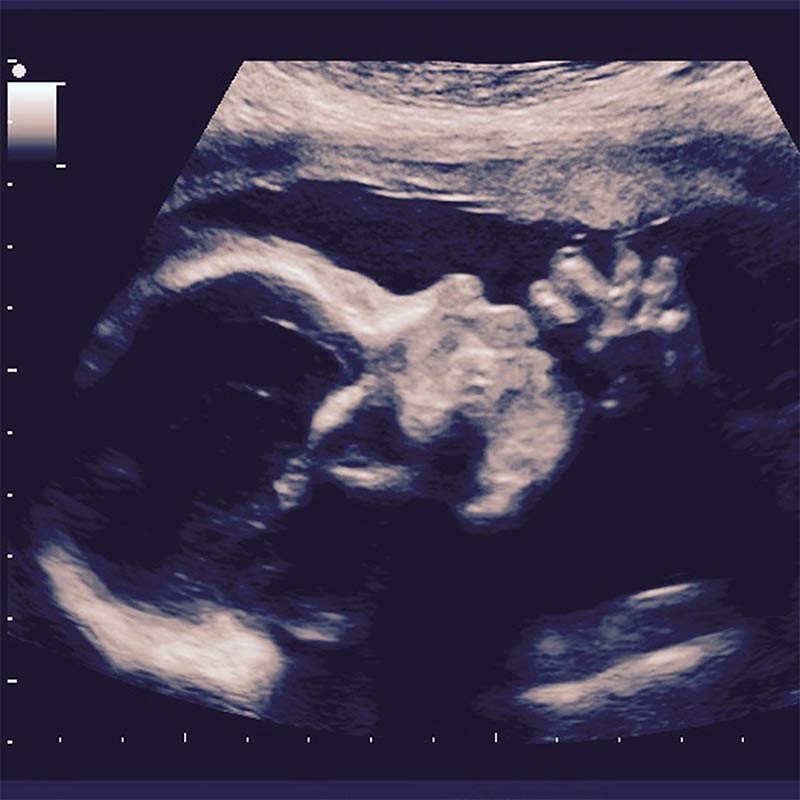 Ultrasound on request
